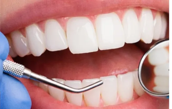 After a dental checkup