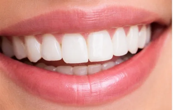After cosmetic dentistry