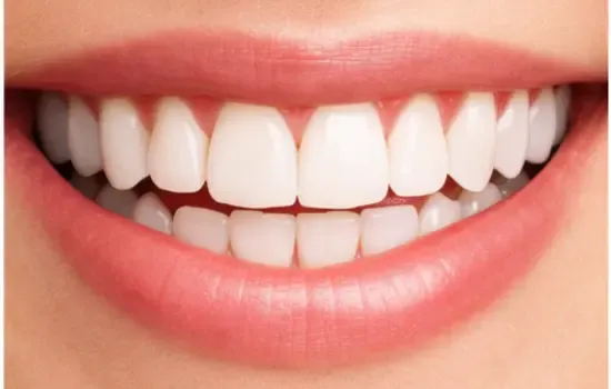 Orthodontic Treatment After-service