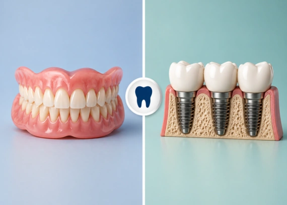 Dentures vs Implants: Which Tooth Replacement Option Is Best for You?